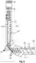 Fig. 10 - METHOD OF MANUFACTURING HEAD FIXATION DEVICE COMPONENTS