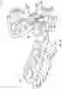 Fig. 02 - Removable dental appliance including spring bellows
