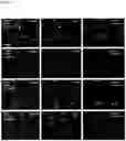 Fig. 07 - Improved CRISPR-Cas9 Genome Editing Tool