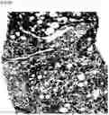 Fig. 12 - COMPOSITION FOR PREDICTING OR DIAGNOSING LIVER DISEASE, AND LIVER DISEASE PREDICTION OR DIAGNOSIS METHOD USING SAME