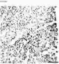 Fig. 15 - COMPOSITION FOR PREDICTING OR DIAGNOSING LIVER DISEASE, AND LIVER DISEASE PREDICTION OR DIAGNOSIS METHOD USING SAME