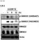 Fig. 20 - COMPOSITION FOR PREDICTING OR DIAGNOSING LIVER DISEASE, AND LIVER DISEASE PREDICTION OR DIAGNOSIS METHOD USING SAME