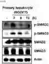 Fig. 21 - COMPOSITION FOR PREDICTING OR DIAGNOSING LIVER DISEASE, AND LIVER DISEASE PREDICTION OR DIAGNOSIS METHOD USING SAME