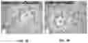 Fig. 07 - METHODS, SYSTEMS, AND COMPOSITIONS RELATING TO TREATMENT OF NEUROLOGICAL CONDITIONS, DISEASES, AND INJURIES AND COMPLICATIONS FROM DIABETES