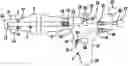 Fig. 01 - SUCTION CATHETER ASSEMBLIES