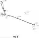 Fig. 02 - Endovascular balloon catheter