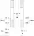 Fig. 01 - Bragg peak detector using scintillators and method of operating the same