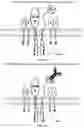 Fig. 09 - Programmable immunocyte receptor complex system