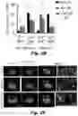 Fig. 05 - Methods of treating Danon disease