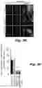 Fig. 09 - Methods of treating Danon disease