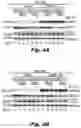 Fig. 10 - Methods of treating Danon disease
