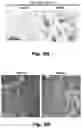 Fig. 30 - Methods of treating Danon disease