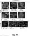 Fig. 32 - Methods of treating Danon disease