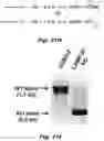 Fig. 38 - Methods of treating Danon disease