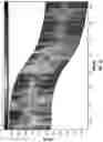 Fig. 08 - Compact logging while drilling look around and look ahead tool