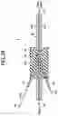 Fig. 04 - Optical coupler and optical amplifier