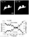 Fig. 14 - Autofocus-control of a microscope including an electrically tunable lens