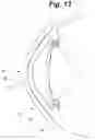 Fig. 09 - Tear shaping for refractive correction