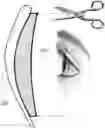 Fig. 01 - Optical element for converting a single-vision lens to a progressive lens