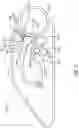 Fig. 03 - Inhibiting ink flow streaks
