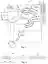 Fig. 02 - SYSTEMS AND METHODS FOR MAKING AND USING A LOW-PROFILE CONTROL MODULE FOR AN ELECTRICAL STIMULATION SYSTEM