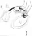 Fig. 24 - Robotic arms