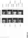 Fig. 131 - Compound chimeric antigen receptor (cCAR) targeting multiple antigens, compositions and methods of use thereof