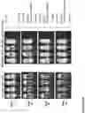 Fig. 158 - Compound chimeric antigen receptor (cCAR) targeting multiple antigens, compositions and methods of use thereof