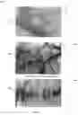 Fig. 04 - Method and apparatus for diagnostic analysis of the function and morphology of microcirculation alterations