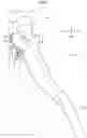 Fig. 02 - Accelerator pedal device for vehicle