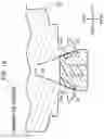 Fig. 14 - Accelerator pedal device for vehicle