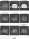 Fig. 09 - Systems and methods for background noise reduction in magnetic resonance images