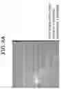 Fig. 12 - Ophthalmological image processing apparatus