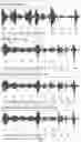 Fig. 06 - System for improving dysarthria speech intelligibility and method thereof
