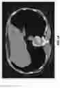 Fig. 02 - MEDICAL IMAGING TIMELINE