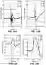Fig. 15 - METHODS FOR SENSING AND ANALYZING IMPACTS AND PERFORMING AN ASSESSMENT