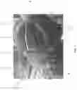 Fig. 02 - Insulation securement system and associated methods