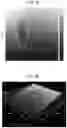 Fig. 03 - Epitaxial silicon carbide single crystal wafer and process for producing the same