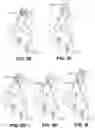 Fig. 07 - Interactive online entertainment system and method for adding face effects to live video