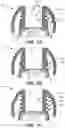 Fig. 07 - Eartips for in-ear listening devices