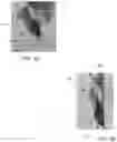 Fig. 07 - SYSTEMS AND METHODS FOR PROVIDING AN EARPIECE