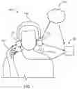 Fig. 02 - Context dependent tapping for hearing devices