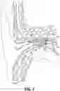 Fig. 04 - Avoidance of user discomfort due to pressure differences by vent valve, and associated systems and methods