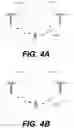 Fig. 04 - Electronic device and method for beam failure recovery