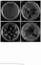 Fig. 02 - Methods to improve genetic transformation of sorghum