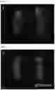 Fig. 32 - Method for producing chimeric animal