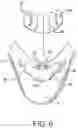 Fig. 07 - Goalie helmet
