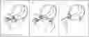 Fig. 01 - LINEAR HAIR TIE