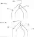 Fig. 04 - Tweezers