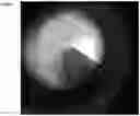 Fig. 32 - Tweezers